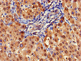 ARG1 / Arginase 1 Antibody - Immunohistochemistry of paraffin-embedded human liver tissue at dilution of 1:100