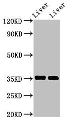 ARG1 / Arginase 1 Antibody - Western Blot Positive WB detected in:Mouse liver tissue,Rat liver tissue All Lanes:ARG1 antibody at 2.8µg/ml Secondary Goat polyclonal to rabbit IgG at 1/50000 dilution Predicted band size: 35 KDa Observed band size: 35 KDa