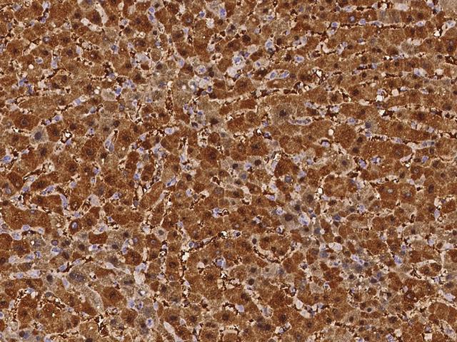 ARG1 / Arginase 1 Antibody - Immunochemical staining of human Arginase in human liver with rabbit polyclonal antibody at 1:2000 dilution, formalin-fixed paraffin embedded sections.