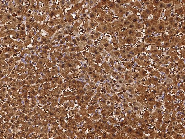 ARG1 / Arginase 1 Antibody - Immunochemical staining of human Arginase in human liver with rabbit polyclonal antibody at 1:2000 dilution, formalin-fixed paraffin embedded sections.
