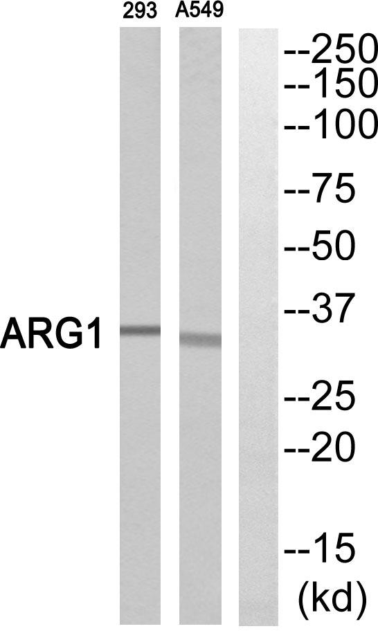 ARG1 / Arginase 1 Antibody - Western blot analysis of extracts from 293 cells and A549 cells, using ARG1antibody.
