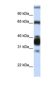 ARG1 / Arginase 1 Antibody - ARG1 / Liver Arginase antibody Western blot of Fetal Liver lysate. This image was taken for the unconjugated form of this product. Other forms have not been tested.