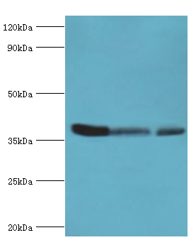 ARG2 / Arginase 2 Antibody - Western blot. All lanes: Arginase-2, mitochondrial antibody at 5 ug/ml. Lane 1: mouse liver tissue. Lane 2: 293T whole cell lysate. Lane 3: mouse kidney tissue. Secondary antibody: Goat polyclonal to rabbit at 1:10000 dilution. Predicted band size: 39 kDa. Observed band size: 39 kDa.