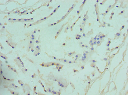 ARG2 / Arginase 2 Antibody - Immunohistochemistry of paraffin-embedded human prostate using antibody at 1:100 dilution.