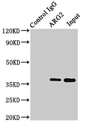 ARG2 / Arginase 2 Antibody - Immunoprecipitating ARG2 in HEK293 whole cell lysate Lane 1: Rabbit control IgG (1µg) instead of ARG2 Antibody in HEK293 whole cell lysate.For western blotting, a HRP-conjugated Protein G antibody was used as the secondary antibody (1/2000) Lane 2: ARG2 Antibody (8µg) + HEK293 whole cell lysate (500µg) Lane 3: HEK293 whole cell lysate (10µg)