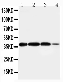 ARG2 / Arginase 2 Antibody - WB of Arginase II / ARG2 antibody. All lanes: Anti-ARG2 at 0.5ug/ml. Lane 1: Rat Lung Tissue Lysate at 40ug. Lane 2: Rat Testis Tissue Lysate at 40ug. Lane 3: A549 Whole Cell Lysate at 40ug. Lane 4: 293T Whole Cell Lysate at 40ug. Predicted bind size: 39KD. Observed bind size: 39KD.