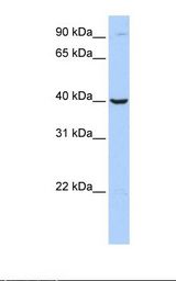 ARG2 / Arginase 2 Antibody - Jurkat cell lysate. Antibody concentration: 1.0 ug/ml. Gel concentration: 12%.  This image was taken for the unconjugated form of this product. Other forms have not been tested.