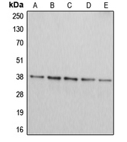 ARG2 / Arginase 2 Antibody - Western blot analysis of Arginase 2 expression in Jurkat (A); HepG2 (B); HEK293T (C); A549 (D); PC12 (E) whole cell lysates.