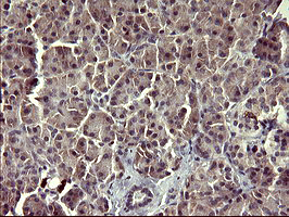 ARG2 / Arginase 2 Antibody - IHC of paraffin-embedded Human pancreas tissue using anti-ARG2 mouse monoclonal antibody. (Heat-induced epitope retrieval by 10mM citric buffer, pH6.0, 120°C for 3min).