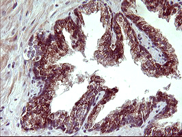 ARG2 / Arginase 2 Antibody - IHC of paraffin-embedded Human prostate tissue using anti-ARG2 mouse monoclonal antibody. (Heat-induced epitope retrieval by 10mM citric buffer, pH6.0, 120°C for 3min).