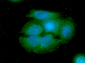 ARG2 / Arginase 2 Antibody - ICC/IF analysis of ARG2 in SW480 cells line, stained with DAPI (Blue) for nucleus staining and monoclonal anti-human ARG2 antibody (1:100) with goat anti-mouse IgG-Alexa fluor 488 conjugate (Green).