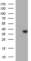 ARG2 / Arginase 2 Antibody - HEK293T cells were transfected with the pCMV6-ENTRY control (Left lane) or pCMV6-ENTRY ARG2 (Right lane) cDNA for 48 hrs and lysed. Equivalent amounts of cell lysates (5 ug per lane) were separated by SDS-PAGE and immunoblotted with anti-ARG2.