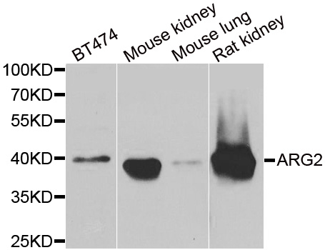 ARG2 / Arginase 2 Antibody - Western blot analysis of extracts of various cell lines.