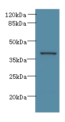 ARG2 / Arginase 2 Antibody - Western blot. All lanes: Arg2 antibody at 10 ug/ml+ Jurkat whole cell lysate Goat polyclonal to rabbit at 1:10000 dilution. Predicted band size: 39 kDa. Observed band size: 39 kDa.