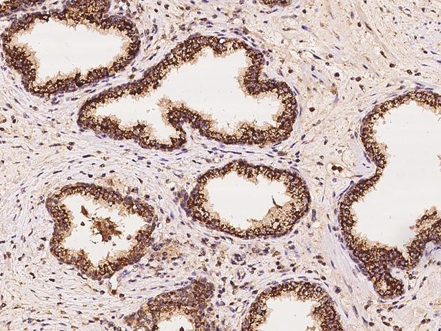 ARG2 / Arginase 2 Antibody - Immunochemical staining of human ARG2 in human prostate with rabbit polyclonal antibody at 1:100 dilution, formalin-fixed paraffin embedded sections.