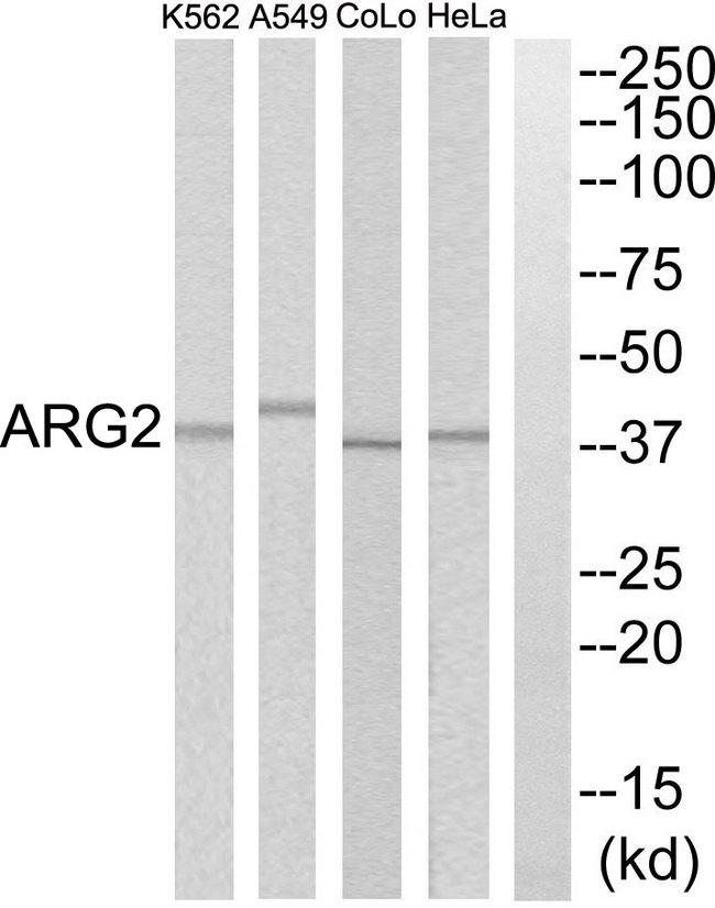 ARG2 / Arginase 2 Antibody - Western blot analysis of extracts from HeLa cells, A549 cells, COLO205 cells and K562 cells, using ARG2 antibody.