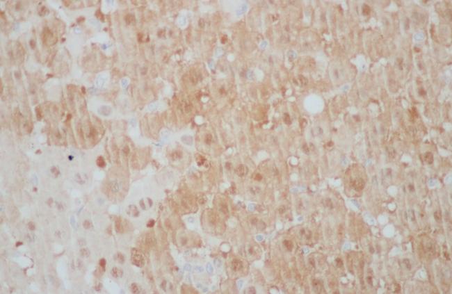 ARG2 / Arginase 2 Antibody - Immunohistochemistry of paraffin-embedded Mouse liver using ARG2 Polyclonal Antibody at dilution of 1:50.