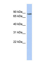 ARG99 / OLF Antibody - TMTC1 antibody Western blot of Fetal Spleen lysate. This image was taken for the unconjugated form of this product. Other forms have not been tested.