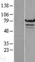 ARG99 / OLF Protein - Western validation with an anti-DDK antibody * L: Control HEK293 lysate R: Over-expression lysate