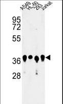ARGLU1 Antibody - Western blot of ARGLU1 Antibody in A549, HL-60, 293, Jurkat cell line lysates (35 ug/lane). ARGLU1 (arrow) was detected using the purified antibody.