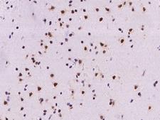 ARGLU1 Antibody - Immunochemical staining of human ARGLU1 in human brain with rabbit polyclonal antibody at 1:500 dilution, formalin-fixed paraffin embedded sections.