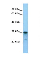 ARGLU1 Antibody - ARGLU1 antibody Western blot of Mouse Spleen lysate. Antibody concentration 1 ug/ml.  This image was taken for the unconjugated form of this product. Other forms have not been tested.