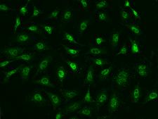 Argonaute 2/3/4 Antibody - Immunofluorescence staining of AGO2 in Hela cells. Cells were fixed with 4% PFA, permeabilzed with 0.1% Triton X-100 in PBS, blocked with 10% serum, and incubated with rabbit anti-Human AGO2 polyclonal antibody (dilution ratio 1:200) at 4°C overnight. Then cells were stained with the Alexa Fluor 488-conjugated Goat Anti-rabbit IgG secondary antibody (green). Positive staining was localized to Nucleus.