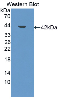 ARH / LDLRAP1 Antibody - Western blot of ARH / LDLRAP1 antibody.