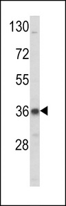 ARH / LDLRAP1 Antibody - Western blot of LDLRAP1 Antibody in K562 cell line lysates (35 ug/lane). LDLRAP1 (arrow) was detected using the purified antibody.