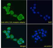 ARH / LDLRAP1 Antibody - ARH / LDLRAP1 antibody immunofluorescence analysis of paraformaldehyde fixed A431 cells, permeabilized with 0.15% Triton. Primary incubation 1hr (10ug/ml) followed by Alexa Fluor 488 secondary antibody (4ug/ml), showing cytoplasmic staining. The nuclear stain is DAPI (blue). Negative control: Unimmunized goat IgG (10ug/ml) followed by Alexa Fluor 488 secondary antibody (2ug/ml).