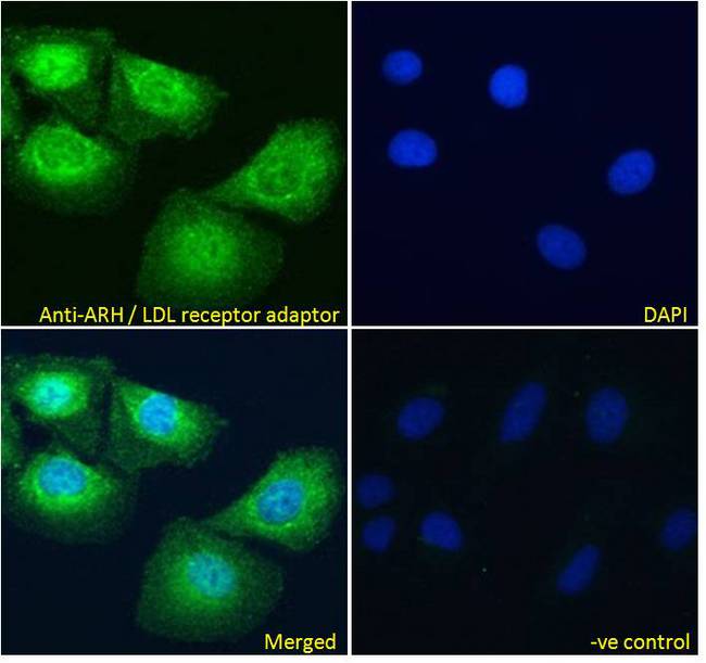 ARH / LDLRAP1 Antibody - ARH / LDLRAP1 antibody immunofluorescence analysis of paraformaldehyde fixed U2OS cells, permeabilized with 0.15% Triton. Primary incubation 1hr (10ug/ml) followed by Alexa Fluor 488 secondary antibody (4ug/ml), showing showing cytoplasmic and some nuclear staining. The nuclear stain is DAPI (blue). Negative control: Unimmunized goat IgG (10ug/ml) followed by Alexa Fluor 488 secondary antibody (4ug/ml).