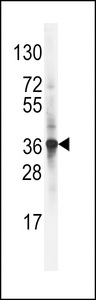 ARH / LDLRAP1 Antibody - Western blot of LDLRAP1 Antibody in NCI-H460 cell line lysates (35 ug/lane). LDLRAP1 (arrow) was detected using the purified antibody.