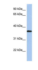 ARH / LDLRAP1 Antibody - LDLRAP1 antibody Western blot of HepG2 cell lysate. This image was taken for the unconjugated form of this product. Other forms have not been tested.