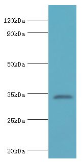 ARH / LDLRAP1 Antibody - Western blot. All lanes: Low density lipoprotein receptor adapter protein 1 antibody at 4 ug/ml+mouse liver tissue. Secondary antibody: Goat polyclonal to rabbit at 1:10000 dilution. Predicted band size: 34 kDa. Observed band size: 34 kDa Immunohistochemistry.