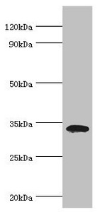 ARH / LDLRAP1 Antibody - Western blot All lanes: Low density lipoprotein receptor adapter protein 1 antibody at 4µg/ml + Mouse liver tissue Secondary Goat polyclonal to rabbit IgG at 1/10000 dilution Predicted band size: 34 kDa Observed band size: 34 kDa