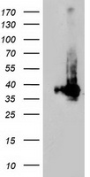 ARH / LDLRAP1 Antibody - HEK293T cells were transfected with the pCMV6-ENTRY control (Left lane) or pCMV6-ENTRY LDLRAP1 (Right lane) cDNA for 48 hrs and lysed. Equivalent amounts of cell lysates (5 ug per lane) were separated by SDS-PAGE and immunoblotted with anti-LDLRAP1.