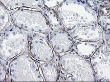ARH / LDLRAP1 Antibody - IHC of paraffin-embedded Human Kidney tissue using anti-LDLRAP1 mouse monoclonal antibody.