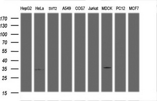 ARH / LDLRAP1 Antibody - Western blot of extracts (35 ug) from 9 different cell lines by using anti-${SYMBOL} monoclonal antibody (HepG2: human; HeLa: human; SVT2: mouse; A549: human; COS7: monkey; Jurkat: human; MDCK: canine; PC12: rat; MCF7: human).