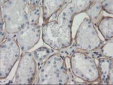 ARH / LDLRAP1 Antibody - IHC of paraffin-embedded Human Kidney tissue using anti-LDLRAP1 mouse monoclonal antibody.