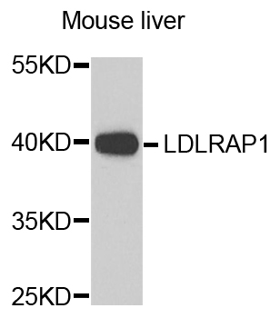 ARH / LDLRAP1 Antibody - Western blot analysis of extracts of mouse liver.