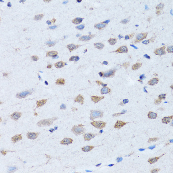 ARH / LDLRAP1 Antibody - Immunohistochemistry of paraffin-embedded rat brain tissue.