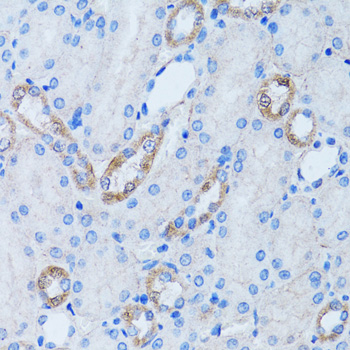 ARH / LDLRAP1 Antibody - Immunohistochemistry of paraffin-embedded rat kidney tissue.