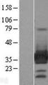 ARH / LDLRAP1 Protein - Western validation with an anti-DDK antibody * L: Control HEK293 lysate R: Over-expression lysate