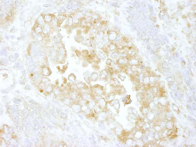 ARHGAP1 / CDC42GAP Antibody - Detection of Mouse Cdc42GAP by Immunohistochemistry. Sample: FFPE section of mouse teratoma. Antibody: Affinity purified rabbit anti-Cdc42GAP used at a dilution of 1:100.