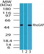 ARHGAP1 / CDC42GAP Antibody - Western blot of human RhoGAP1 in HeLa cell lysate in the 1) absence, 2) presence of immunizing peptide and 3) Raw cell lysate using antibody at 0.5 ug/ml.