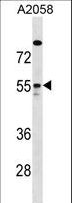ARHGAP1 / CDC42GAP Antibody - ARHGAP1 Antibody western blot of A2058 cell line lysates (35 ug/lane). The ARHGAP1 antibody detected the ARHGAP1 protein (arrow).