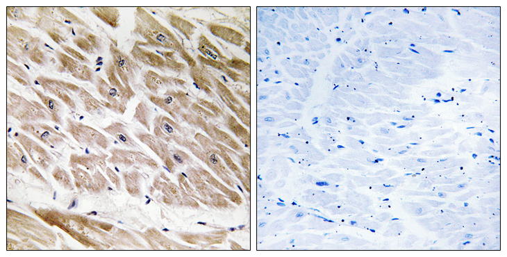 ARHGAP1 / CDC42GAP Antibody - Immunohistochemistry analysis of paraffin-embedded human heart tissue, using RHG1 Antibody. The picture on the right is blocked with the synthesized peptide.