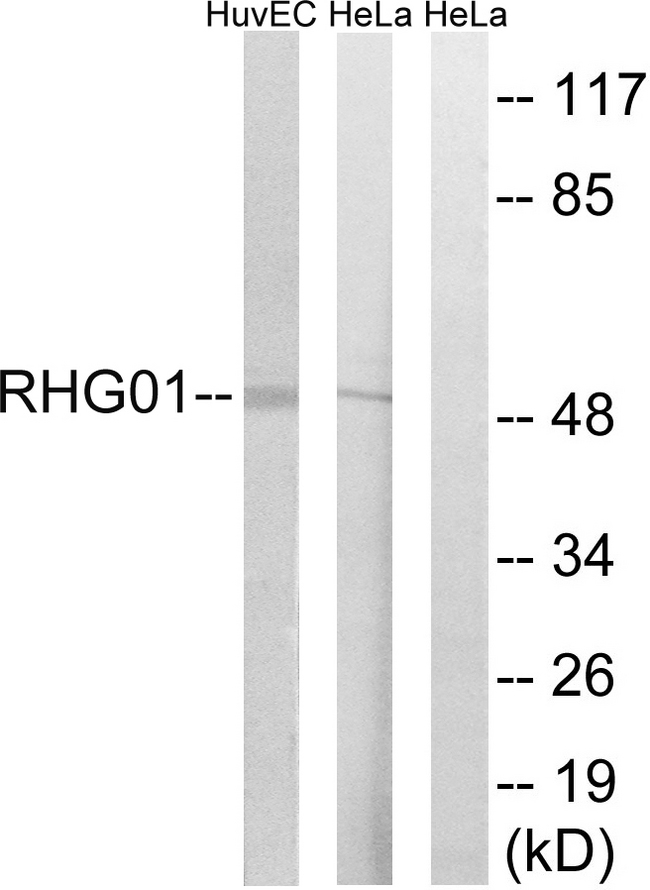 ARHGAP1 / CDC42GAP Antibody - Western blot analysis of lysates from HeLa and HUVEC cells, using RHG1 Antibody. The lane on the right is blocked with the synthesized peptide.