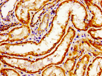 ARHGAP1 / CDC42GAP Antibody - Immunohistochemistry image of paraffin-embedded human kidney tissue at a dilution of 1:100
