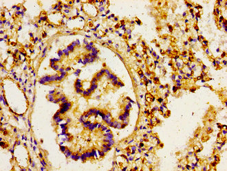 ARHGAP1 / CDC42GAP Antibody - Immunohistochemistry image of paraffin-embedded human lung tissue at a dilution of 1:100